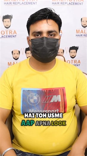 Hair Patches for Men #hairpatchesformen #hairpatches