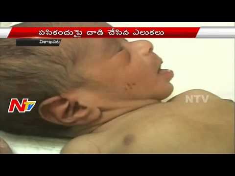Mother Abandoned Newborn Baby In Drianage | Rats Eat Toes Of Infant | Visakha | NTV