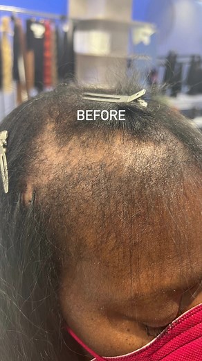 Micro Brazilian Knots For Thin Hair