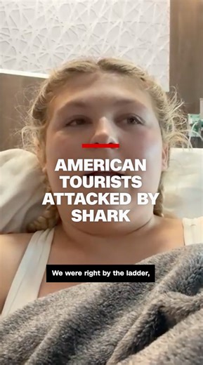 90K views · 335 reactions | Two American tourists share their story of the day they were attacked by a shark in the Bahamas. While unprovoked shark attacks are rare in the Bahamas, this is at least the third reported shark attack involving American tourists since 2023. Read more: https://cnn.it/42MyQUq | CNN | Facebook