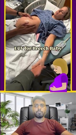 🤰🏼मेरी माँ 💖ECV for Breech Baby🩺 🤍👣 #sleep new born baby #shortsfeed #newbornbaby #shorts #cutebaby
