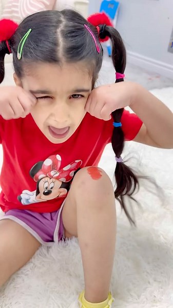Boo boo song #kidsshorts #booboo #kidsrhymes #kidssongs
