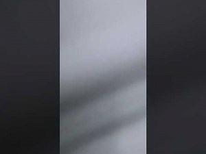 How to Locate Deep Inguinal Ring/clinicalMethod/Direct&Indirect Inguinal Hernia /RingOcclusionTest/