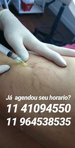 Sabe aquele vasinho que te incomoda tanto? Diga ADEUS a eles e diga SIM para o método de Aplicação P.E.I.M  ⠀ * COM SESSÕES A PARTIR DE R$ 105,00. ⠀ Venha fazer uma Avaliação e sanar suas dúvidas em nossa Clínica. Entre em contato:  11 94885.2957 / 11 94952-7168 ⠀ ACEITAMOS CARTÕES DE CRÉDITO E DÉBITO. . | Instituto Anna Rita Azevedo | Facebook