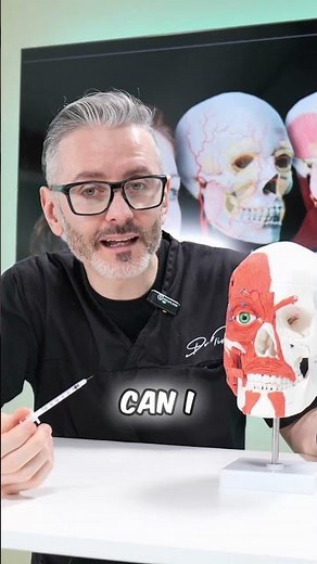 Masseter Injection Point