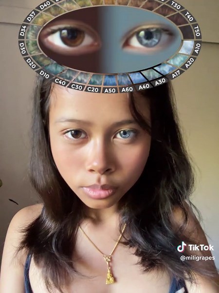 Understanding Heterochromia: Unique Eye Color Variations