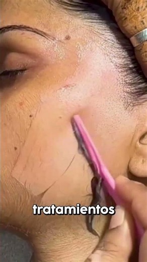 Esto es DERMAPLANING 💖✨ para esto sirve