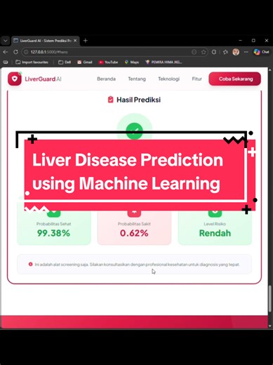 Liver Disease Prediction Using Machine Learning Techniques