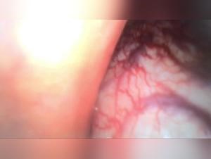 Dog Knot Inside Woman Extreme Sex