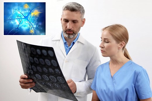 New MRI brain scan can help predict Alzheimer’s before symptoms begin