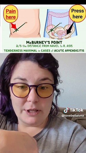 Replying to @lovebellaluna Tips from a doc on how to test for Appendicitis at home! #appendicitischeck #appendicitis