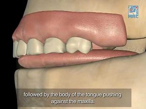 Normal Swallow affecting Dental & Facial Development