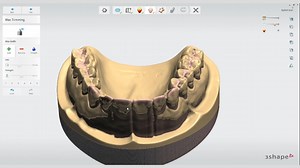 3shape咬合板颌架设计