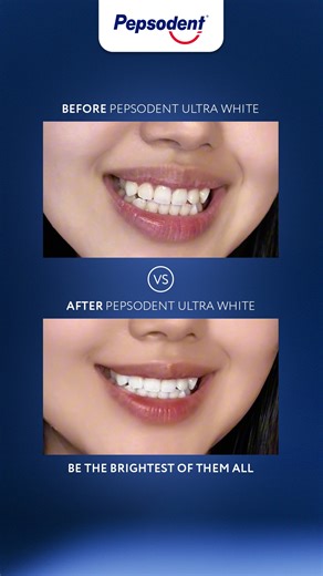 1.3K views | One routine switch, one major smile transformation✨ Pepsodent Ultra White gives you gentle whitening for a naturally perfect brighter smile. Stay tuned for deals you don’t want to miss ✨ #TheBrightestOfThemAll | Pepsodent | Facebook