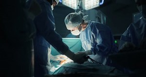 Diverse Surgical Team Working Darkened Operating Stock Footage Video (100% Royalty-free) 3643156873 | Shutterstock