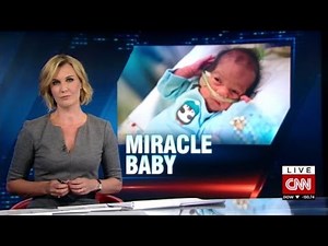 Doctor on delivering baby to brain-dead mother