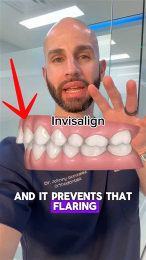 Fixing teeth flaring with adult Invisalign ￼