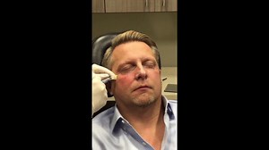 Restore a Youthful Look to Your Face Non-Surgically With Restylane Silk