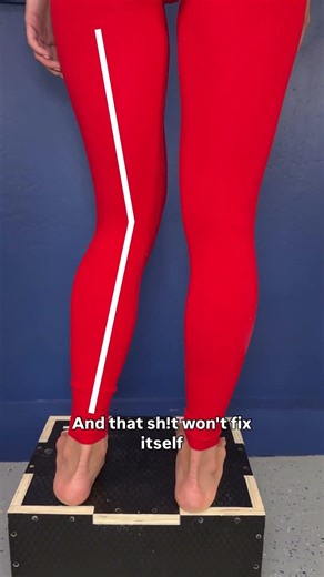 The Real Cause of Your Uneven Hips