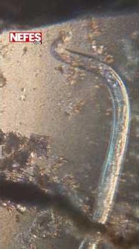 Back after 60 years: Flesh-eating parasite panic