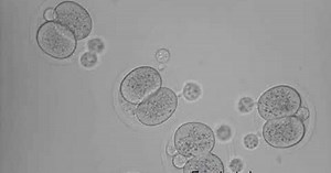 Researchers claim stem cell advance