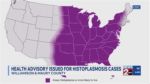 Health advisory issued for histoplasmosis cases in Tennessee