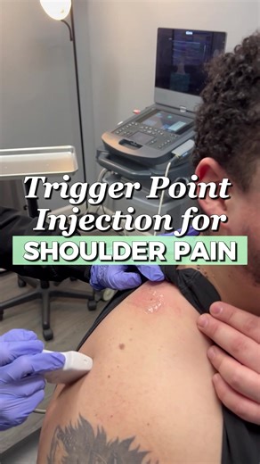 A trigger point is a tight knot or band of muscle that forms when a muscle cannot relax. These can be caused by stress, using the muscle too much, problems with the spine or posture, imbalances in strength and flexability, repetitive injury, or simply not drinking enough water. A trigger point injection is a shot directly into the area of pain or discomfort. Its job is to relax the muscle and relieve pain. This helps improve blood flow and healing in the affected area. Even though our massage th