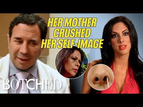 Tania’s Boyfriend Pressured Her to Get A Nose Job and It Went Wrong (Before & After) | Botched | E!