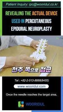 Neuroplasty: What Happens During the Procedure?