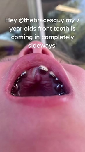 Teeth Alignment Recommendations by Candice Von Vogt