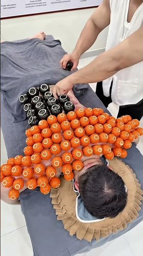 What Is Cupping Therapy? Ancient Healing Explained