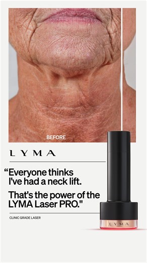 The future of skin transformation is here. Revolutionary clinic-grade cold laser technology, engineered to make skin look younger. | LYMA | Facebook