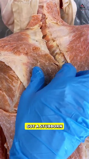 💥 Got a Stubborn Knot Between Your Shoulder Blades That Never Goes Away? Stop Just Rolling It 💥 If you’ve rolled, stretched, and smashed that same spot between your shoulder blades and it keeps coming back… That “knot” is usually a symptom, not the root cause. When your upper back, shoulder blade, and ribs don’t move or share load well, one area in the mid‑back gets stuck doing double duty. Here’s how to change the pattern 👇 🌀 Open Book – Restores rotation through your upper back and rib cag