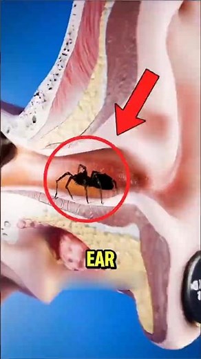 What To Do If A Spider Crawls Into Your Ear 🕷️