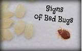Bed Bug Treatment On Body Images