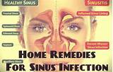 Sinusitis Home Remedies In Telugu Images