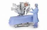 Davinci Robot For Hysterectomy