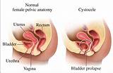 Vitamins For Pelvic Floor Muscles Images