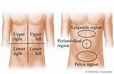 Trap Gas In Lower Stomach Images