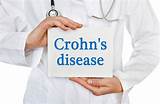 Images of Crohn''s Doctor