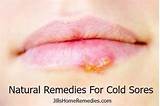 Images of Cold N Fever Home Remedies