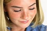 Images of Makeup Tutorial For Freckles