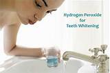 Photos of Using Hydrogen Peroxide To Whiten Teeth