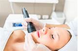 How Much Do Laser Hair Removal Treatments Cost Images