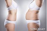 Pictures of Large Volume Liposuction Doctors