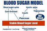 High Blood Sugar Emergency Treatment Pictures