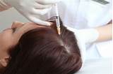 Which Doctor To See For Hair Loss Treatment Pictures
