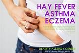 Eczema In Elbow Crease Treatment Images