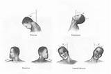 Images of Neck Stretching Exercises