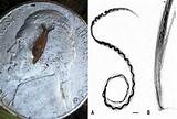 Rat Lungworm Disease Hawaii Pictures